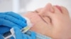 Specialiștii spun că, dacă este injectat corect, acidul hialuronic nu este periculos. 