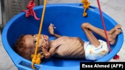 طبق آمارهای سازمان ملل، از زمان شروع حملات هوایی عربستان در مارس ۲۰۱۵ حداقل هزار و ۲۴۸ کودک یمنی کشته شده‌اند.