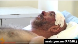 ИЗбитый Смбат Акопян в больнице, 21 сентября 2015 г.