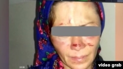 Яке аз қурбониёни шиканҷа дар оила
